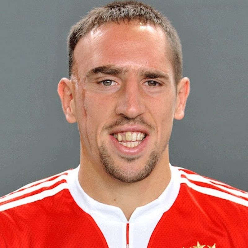 Franck Ribery - cầu thủ với gương mặt đặc biệt